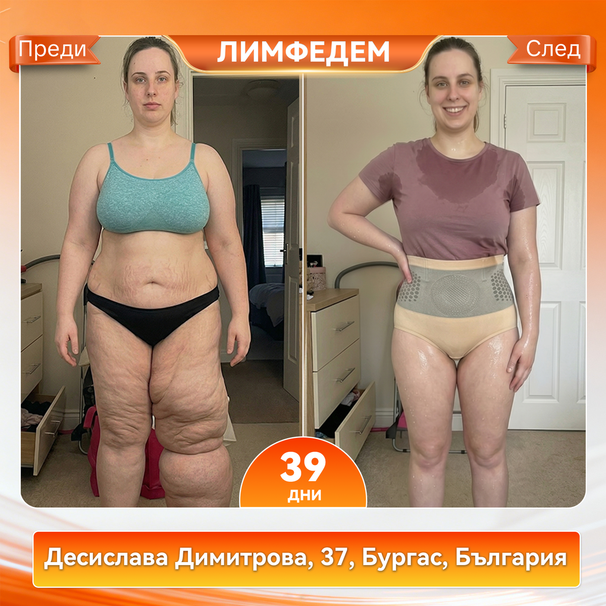 ⭐🐴Официален магазин |𝐕𝐄𝐋𝐍𝐎𝐑𝐀® 𝟐𝟎𝟐𝟔 МОРИНГА И БЕРБЕРИН 4 B 1 Къси Панталони За Скулптуриране С Микрочастици И Изгаряне На Мазнини