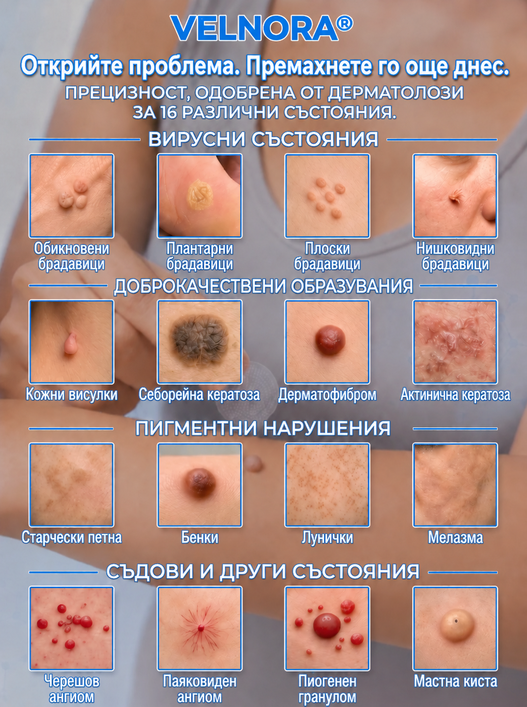⭐🐒 Официален магазин | 𝐕𝐄𝐋𝐍𝐎𝐑𝐀® Билков хидроколоиден пластир с микроигли (за кожни образувания, малки кожни израстъци, брадавици, бенки, старчески петна и пигментни петна)
